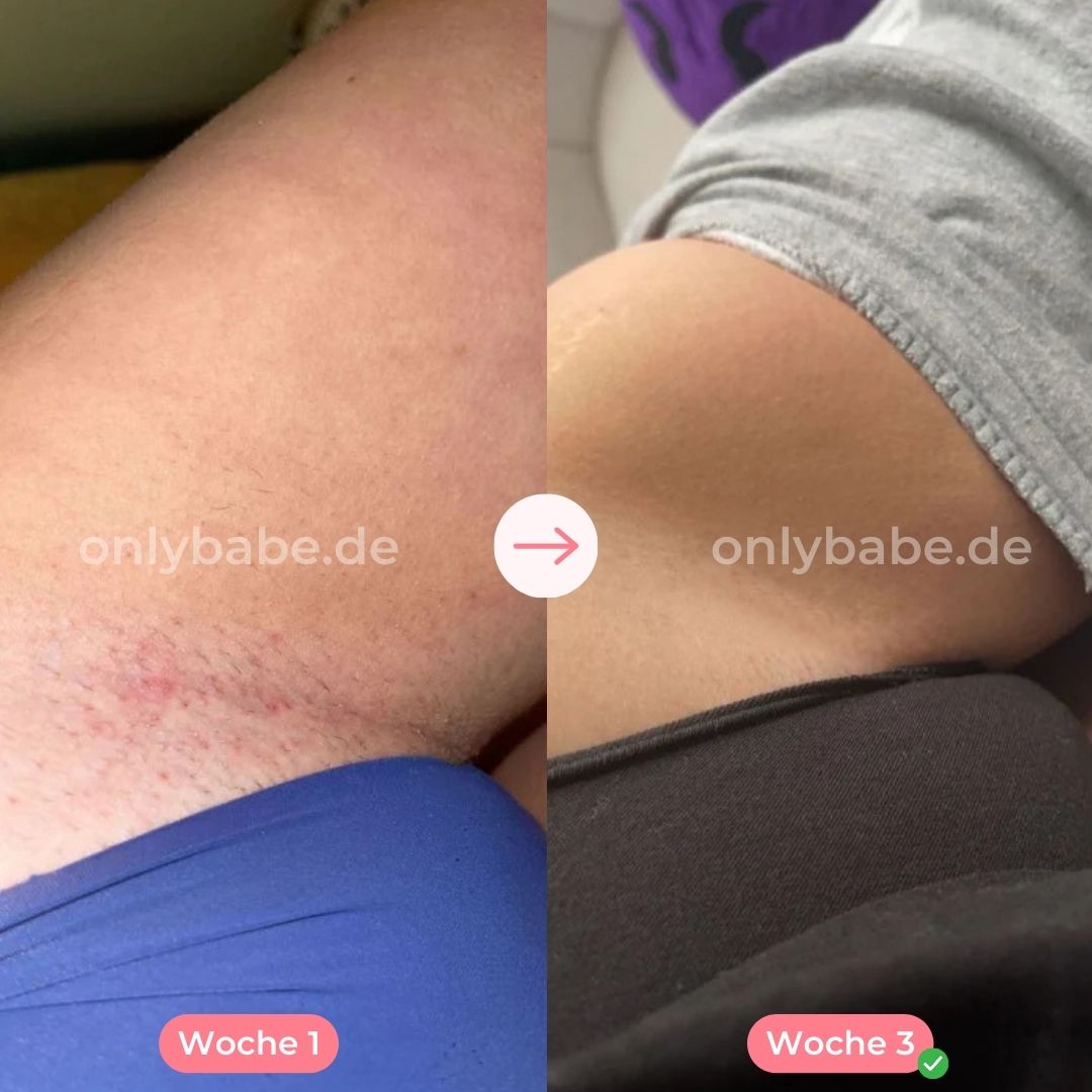 ONLYBABE IPL PRO™